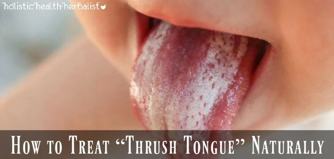 Treating Thrush